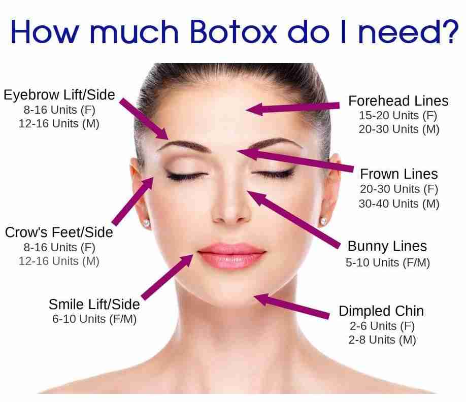 Allergan – Therapeutic / Cosmetic – Botox, 100 Units/Vial